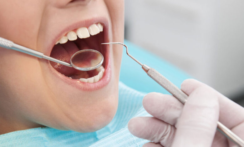Dental Filling Treatment in Aurora & Denver
