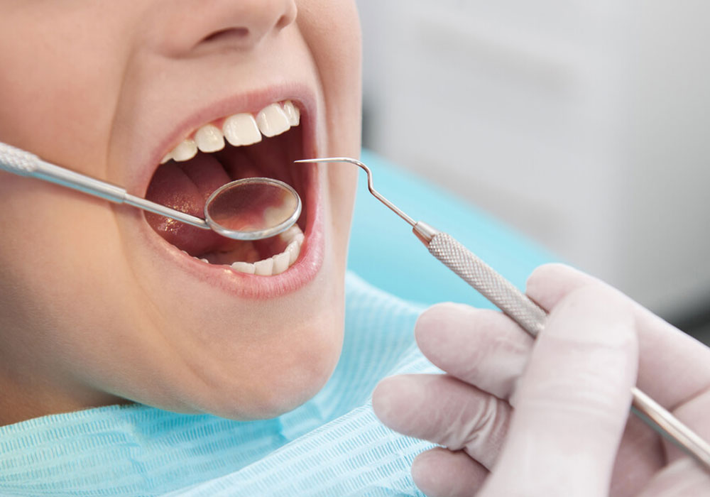 Dental Filling Treatment in Aurora & Denver
