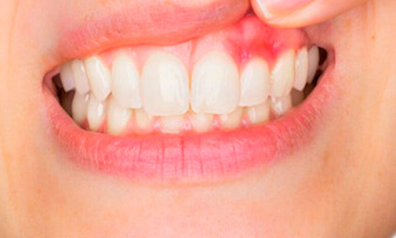 Pediatric Dentist Aurora