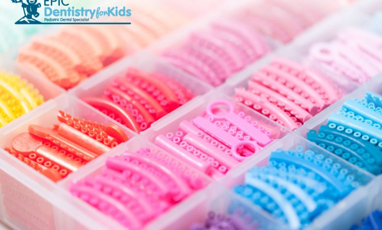 Braces color combinations are not something you should forget about